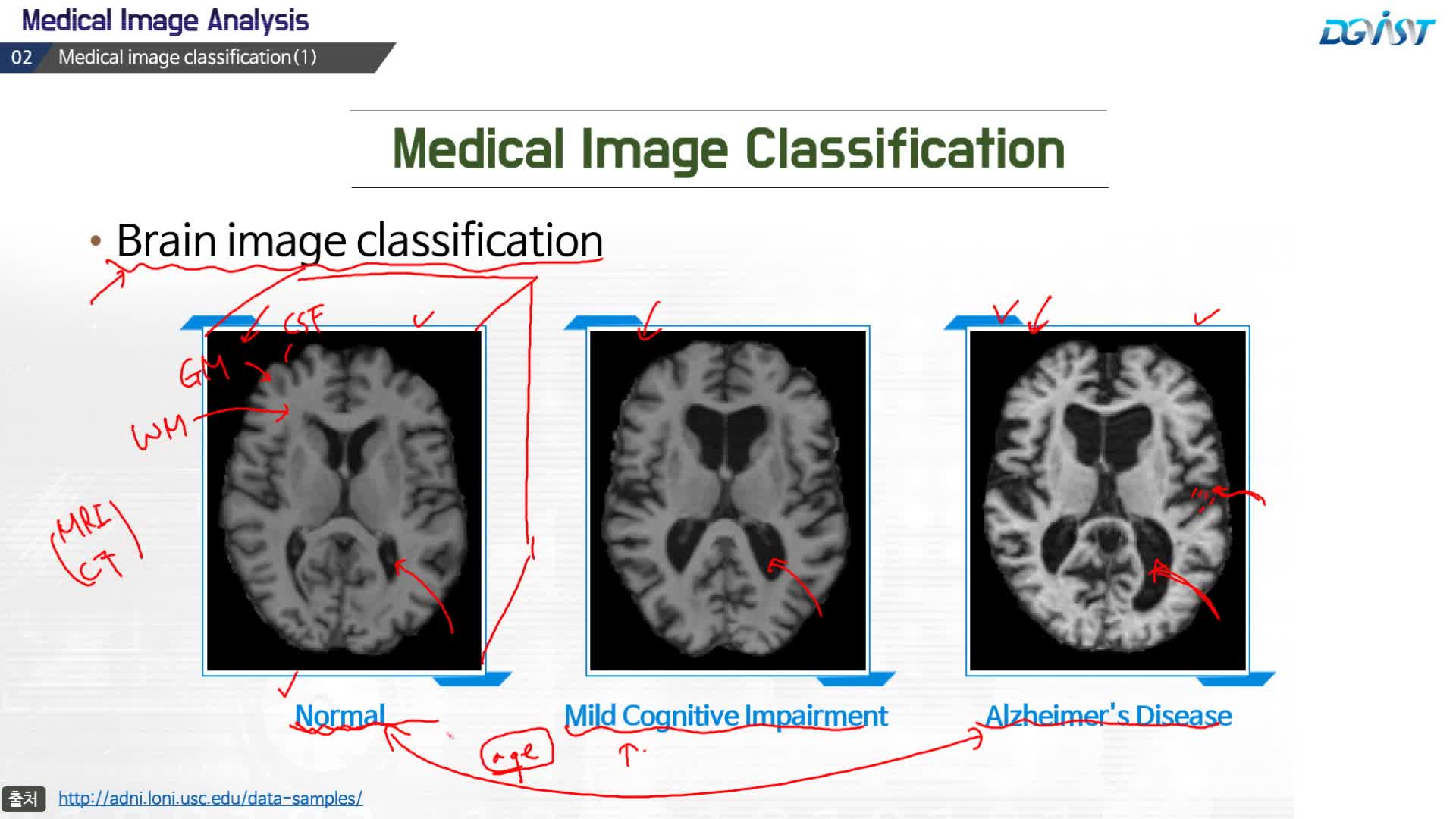 컴퓨터비전, 머신러닝, 딥러닝을 이용한 의료영상분석 > 1.Introduction to medical image
